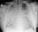 Abb. 2: Radiologischer Befund