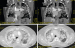 Aktuelles Bild - Abb. 3: CT-Angiographie