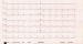 Aktuelles Bild - Abb. 3: EKG