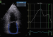 Aktuelles Bild - Abb. 2: 2D-Strain