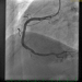 Abb. 3: Angiogramm