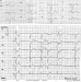 Abb. 1: EKG