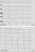 Abb. 6: EKG