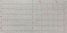 Abb. 3: EKG - Kontrolle