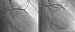 Abb. 4: Koronarmorphologie
