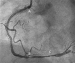 Abb. 3: Angiographie