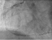 Abb. 7: RCA - DES