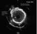 Aktuelles Bild - Abb. 8: IVUS