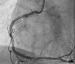 Abb. 10: RCA - ISR