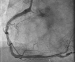Aktuelles Bild - Abb. 12: Angiographie