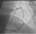 Abb. 1: Aneurysma