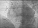 Abb. 2: OCT