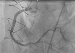 Abb. 8: OCT