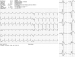 Abb. 2: EKG