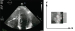 Abb. 1: Echo - Myokard-Speckles