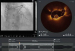 Abb. 1: Video 1
