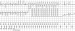 Abb. 2: Polymorphe VT 