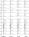 Abb. 1: High-Pass-Filter