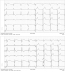 Abb. 3: Low-Pass-Filterung
