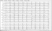 Aktuelles Bild - Abb. 1: 12-Ableitungs-EKG