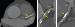 Abb. 2: Coronary-CT