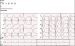 Aktuelles Bild - Abb. 1: EKG