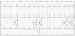 Aktuelles Bild - Abb. 2: Analyse