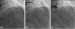 Abb. 1: Balloon