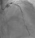 Abb. 2: Angiography
