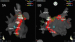 Abb. 5: Elektroanatomisches Mapping