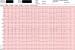 Aktuelles Bild - Abb. 1: EKG