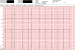Abb. 3: EKG