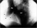 Fig. 2: Mediastinale Masse