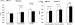 This Image - Fig. 1: Koronare Herzkrankheit - Dipyridamol-Streßechokardiographie