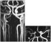 Abb. 1: Arteria carotis - Perfusion