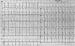 Aktuelles Bild - Abb. 1: Subakute Stentthrombose - Fallbericht