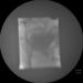 Abb. 7: Scott-Spinkter-Implantation - Insuffizienter Blasenhals