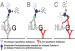 Abb. 3: sHLG-G-Fangantikörper-ELISA-Aufbau