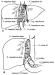 Abb. 5: Lebertransplantion - Operation