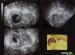Abb. 2: Embryo - 3D-Ultraschall