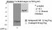 Abb. 2: LIVE-Studie - Linksherzhypertrophie