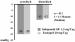 Abb. 4: LIVE-Studie - Linksherzhypertrophie