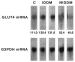 Fig. 1: Northern Blot of RNA