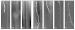 Abb. 1: Beinischämie