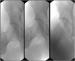 Abb. 5: Stengraft