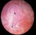 Aktuelles Bild - Abb. 3: GD1-Embryo