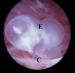 Abb. 4: GD2-Embryo