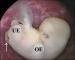 Abb. 7: Triploider Embryo