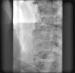 Abb. 8: Abschlußangiographie