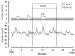 Abb. 2: Amenorrhö - LH - FSH-